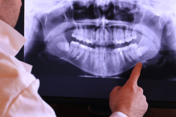Best Emergency Tooth Extraction in Waterville, OH